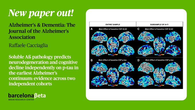 Amyloid beta accumulation confirmed to cause early brain damage in Alzheimer’s